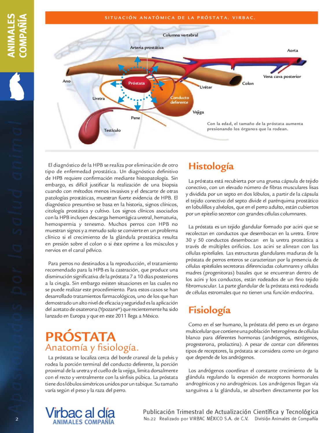 prostata de estructura heterogenea