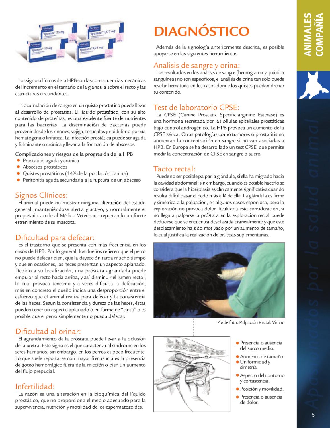 prostatitis y ausencia de espermas