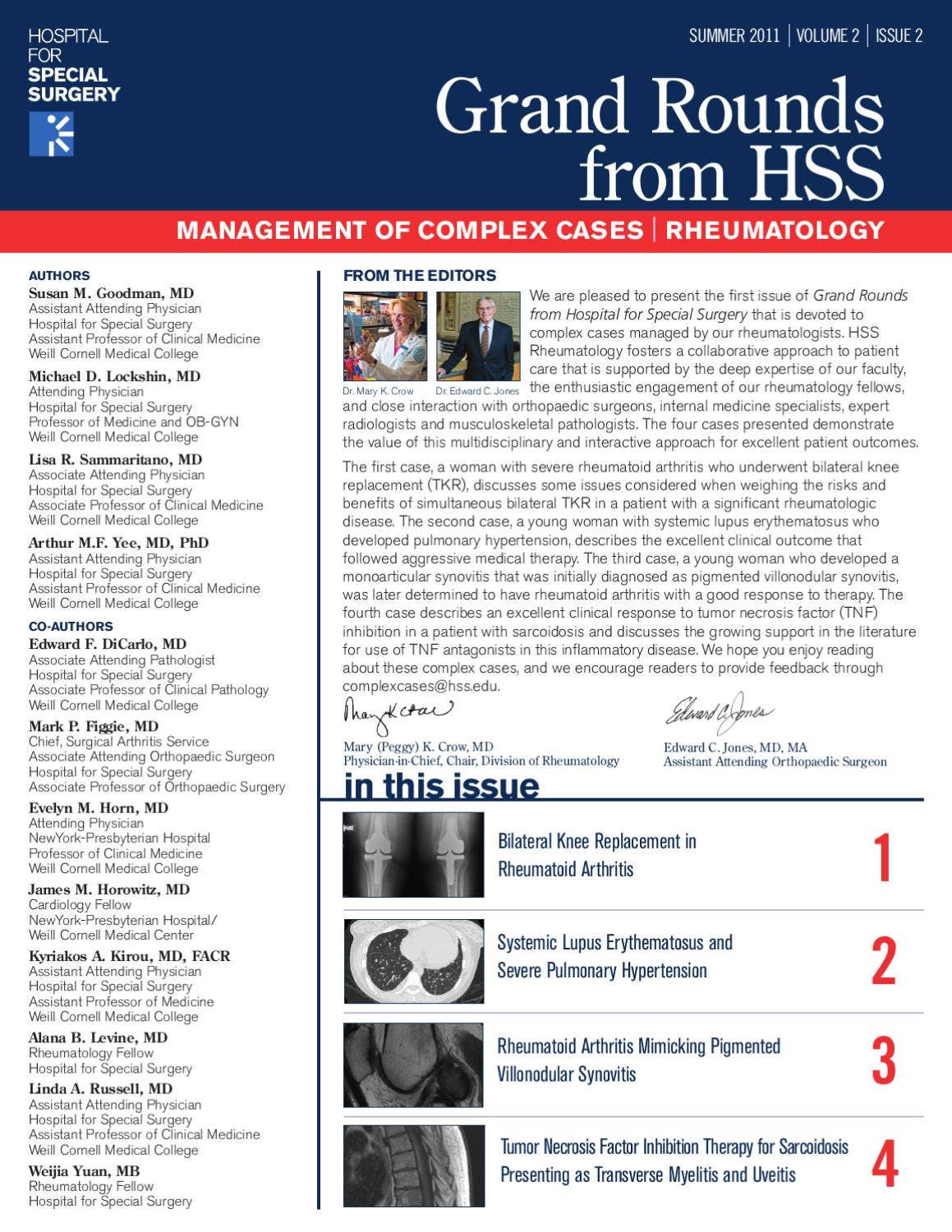 Grand Rounds from HSS--Management of Complex Cases, Rheumatology by ...