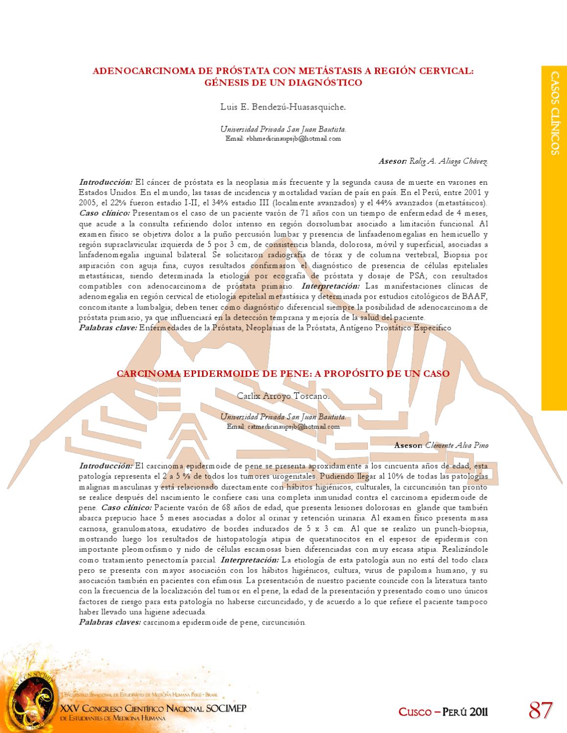 próstata adenomegalia