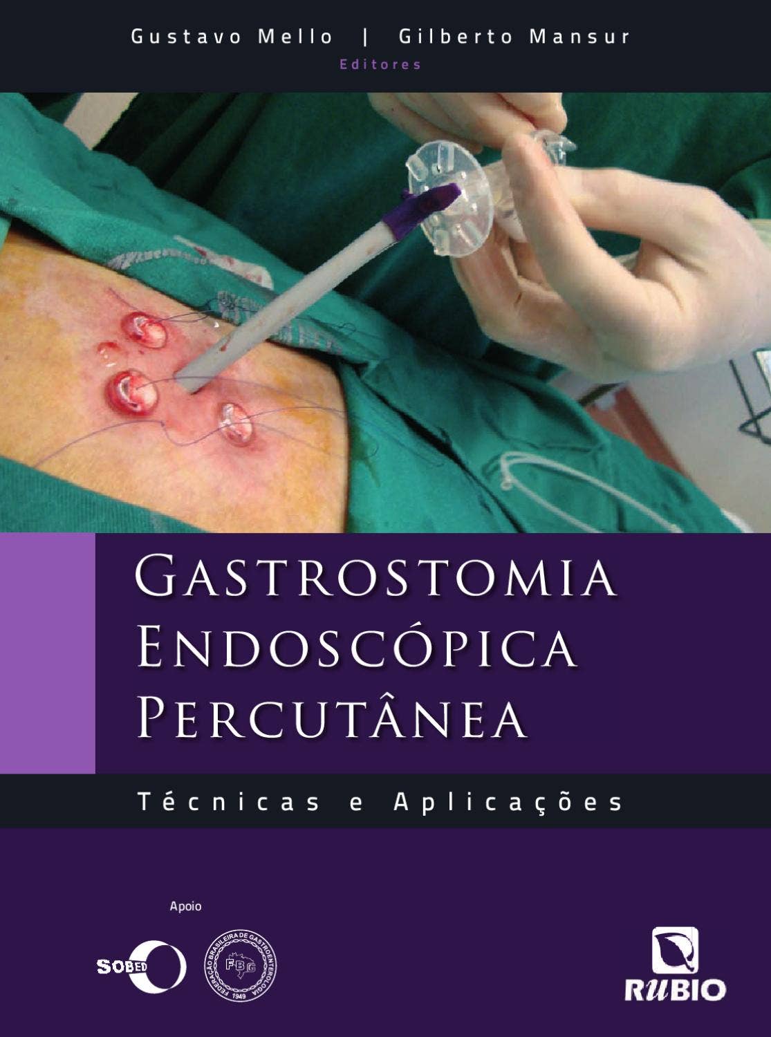 Perilunate carpal dislocation. Clinical evaluation of patients operated  with reduction and percutaneous fixation without capsula, image size:1115x1500
