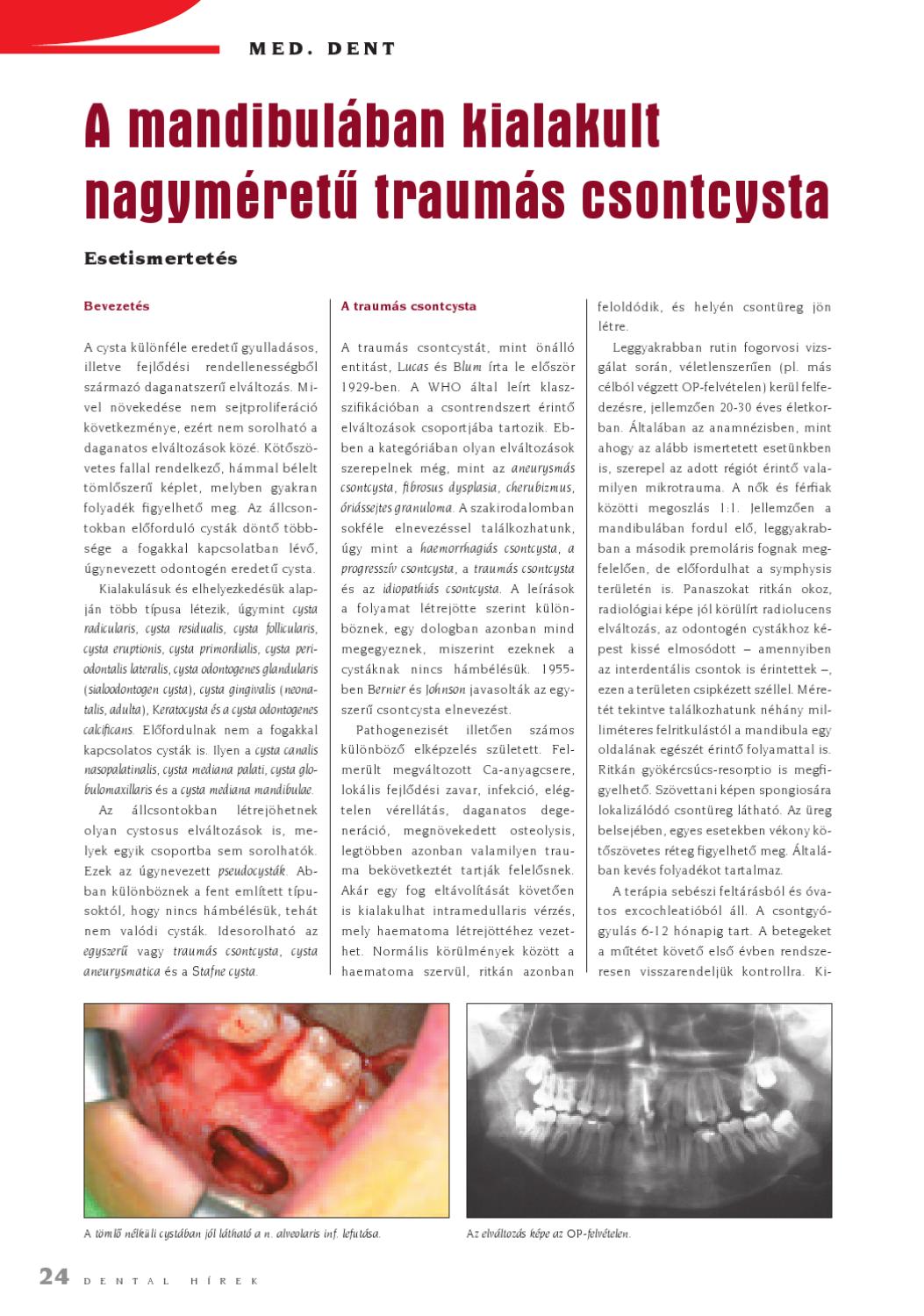Dental Hírek 2010. 2.szám by Dental Press Hungary Issuu