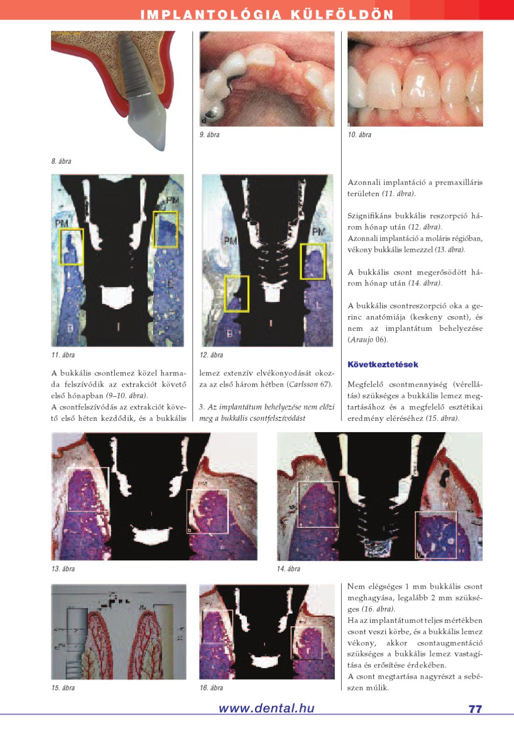Implantológia 2010. 1. szám by Dental Press Hungary Issuu
