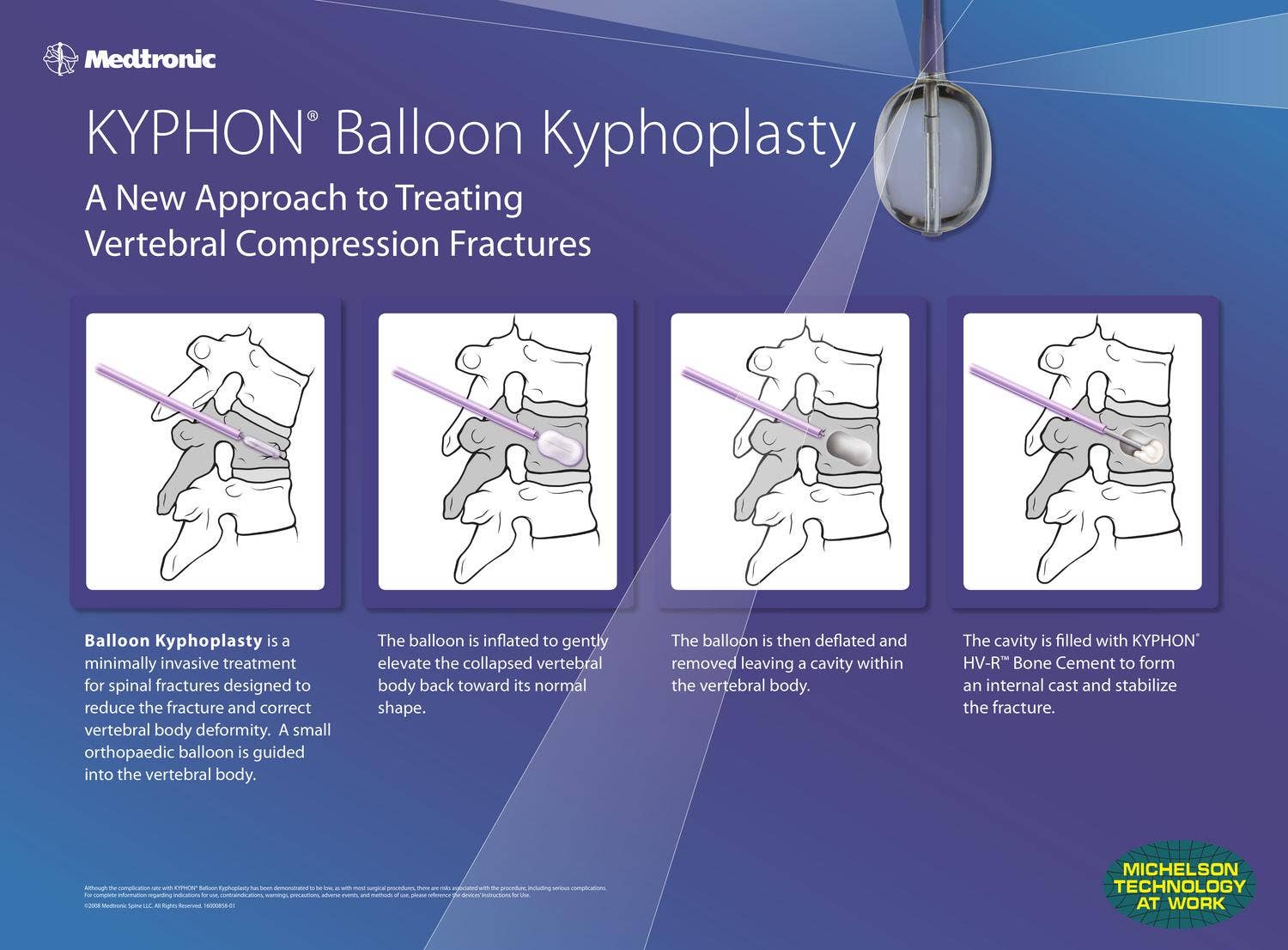 Kyphon Kyphon Booth Panels by Chikamura Design - Issuu