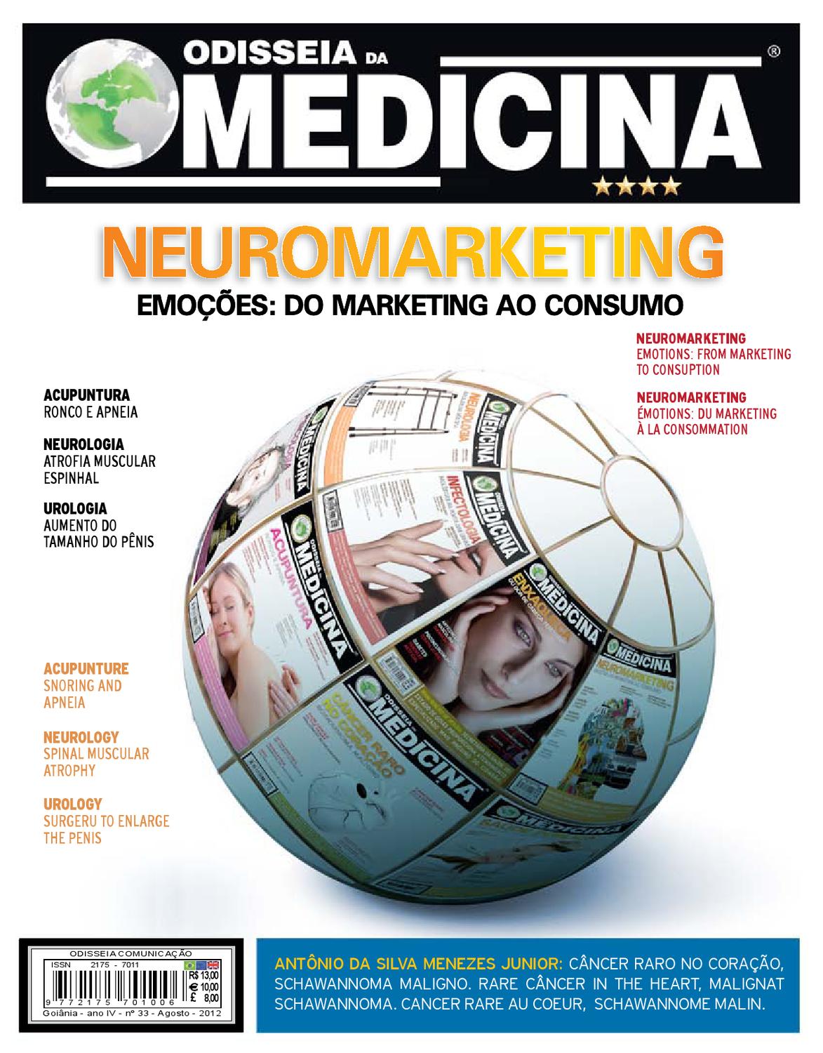neurinoma lombaire síntomas de diabetes neurinoma lombaire síntomas de diabetes