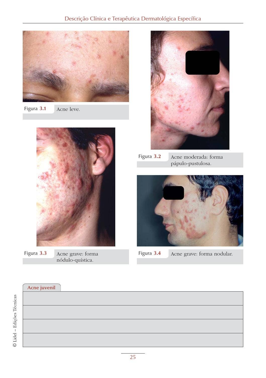 Dermatologia Básica em Medicina Familiar by Grupo Lidel - Issuu