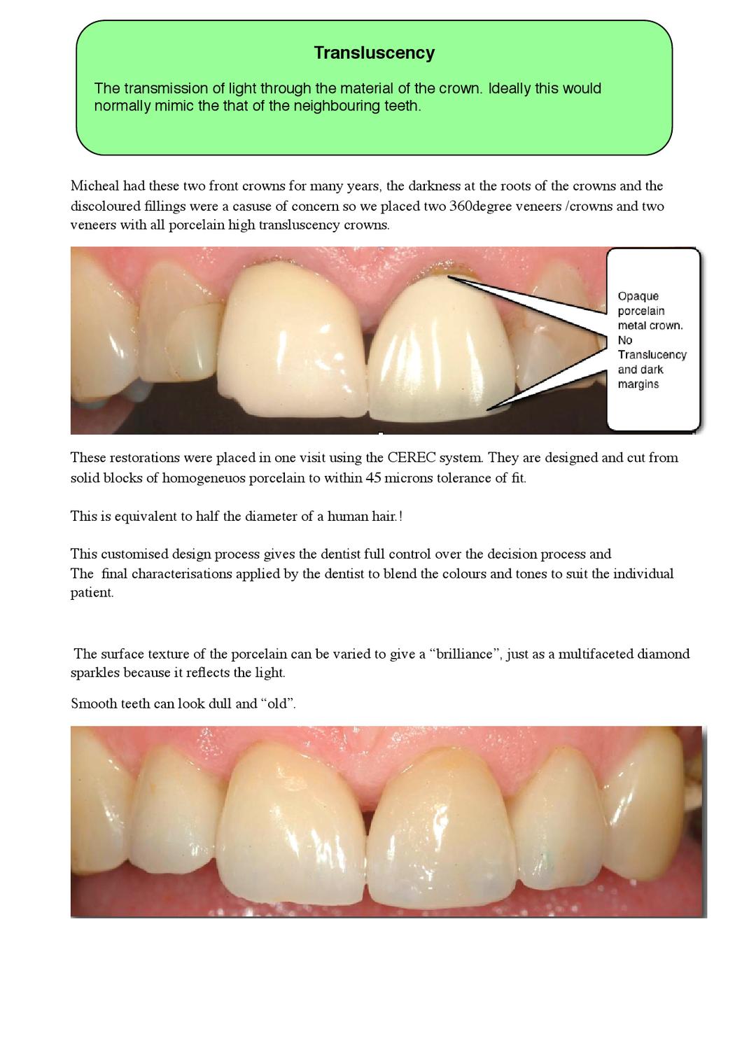 How Much Is A Crown >> How Much Is Dental Crown By Gate Clinic Issuu How Much Is A Crown >> How Much Is Dental Crown By Gate Clinic Issuu