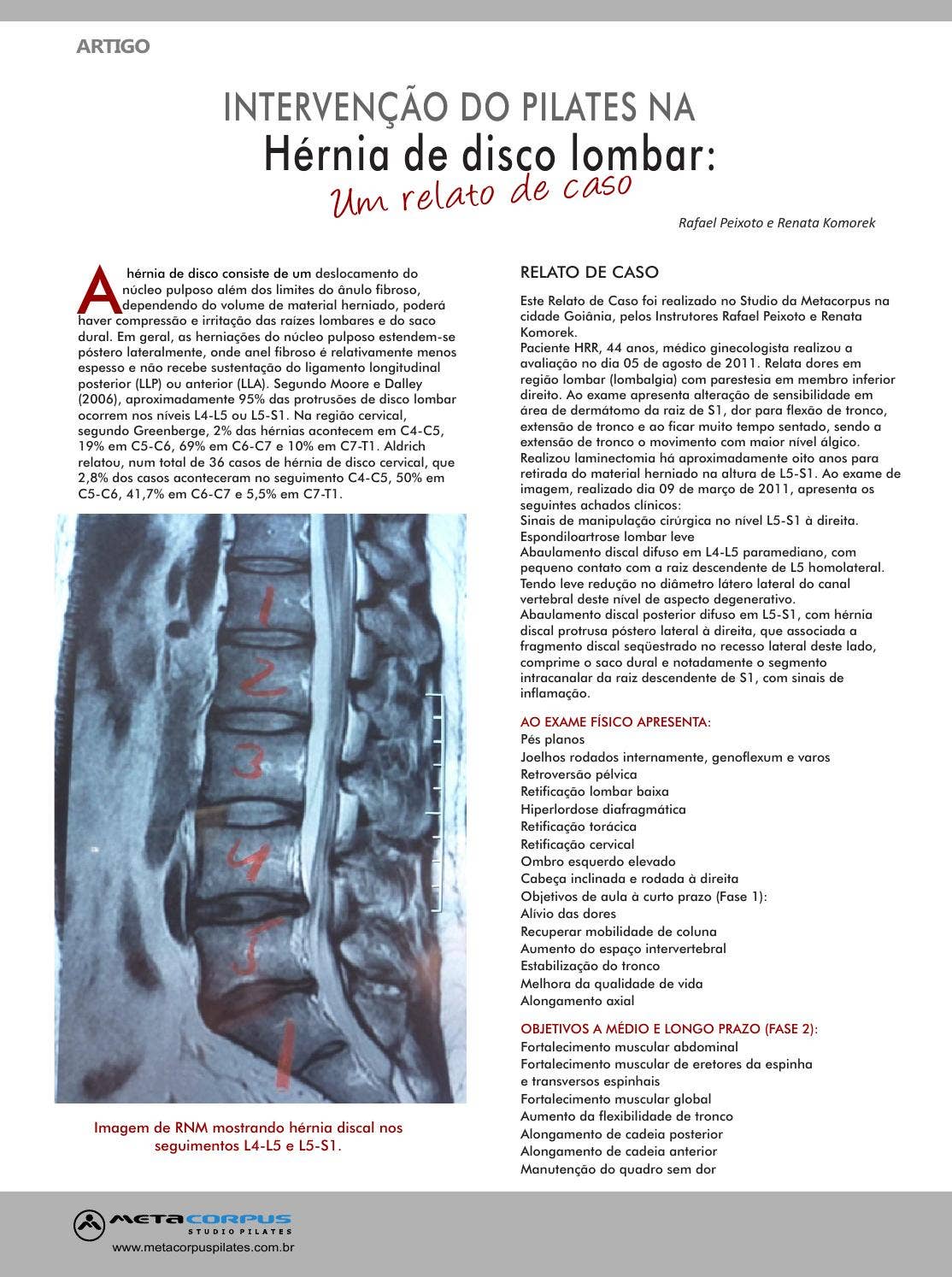 Anatomia da Coluna Vertebral | PDF | Coluna vertebral | Vértebra, image size:1114x1494