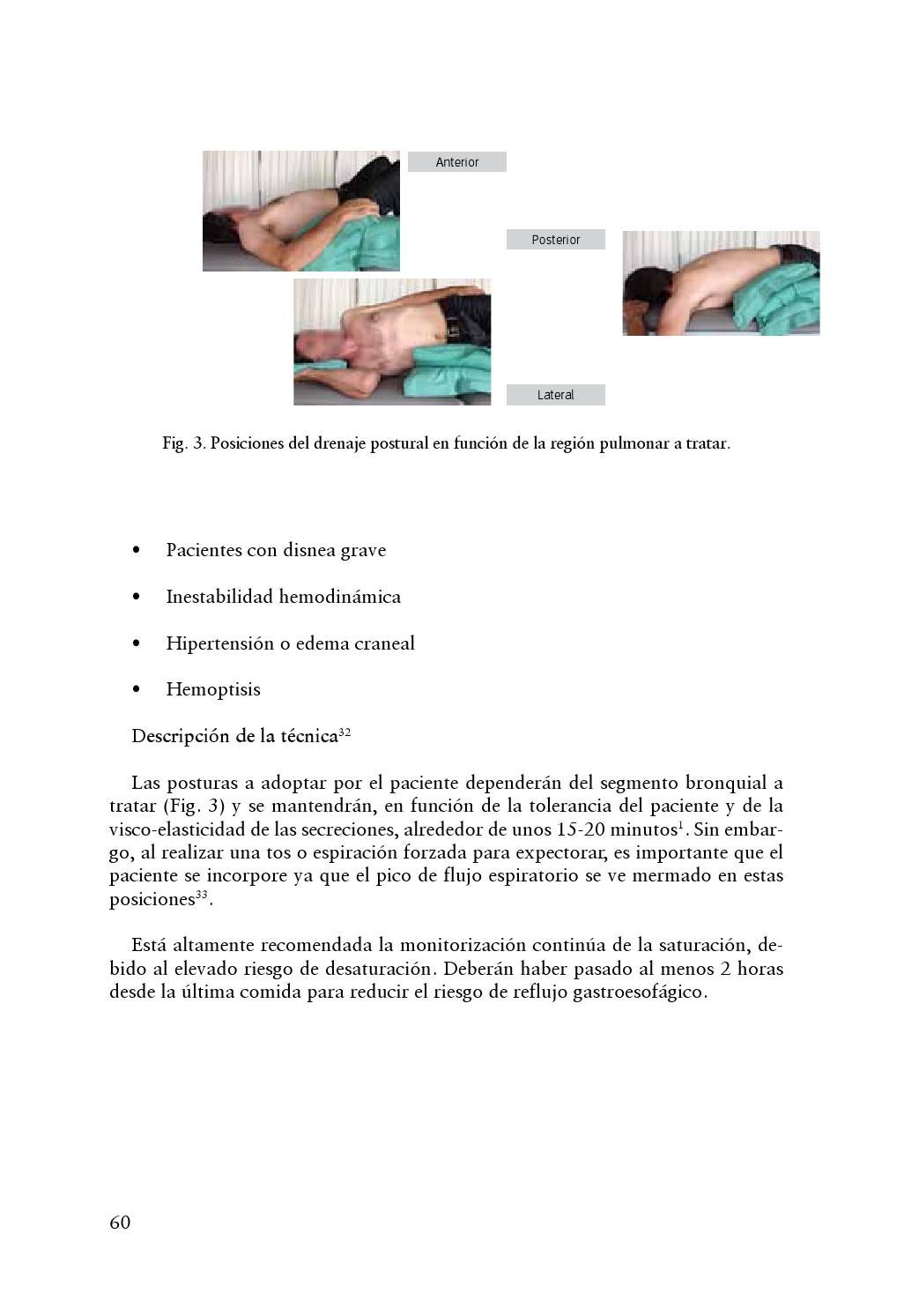 que es el drenaje postural que es el drenaje postural