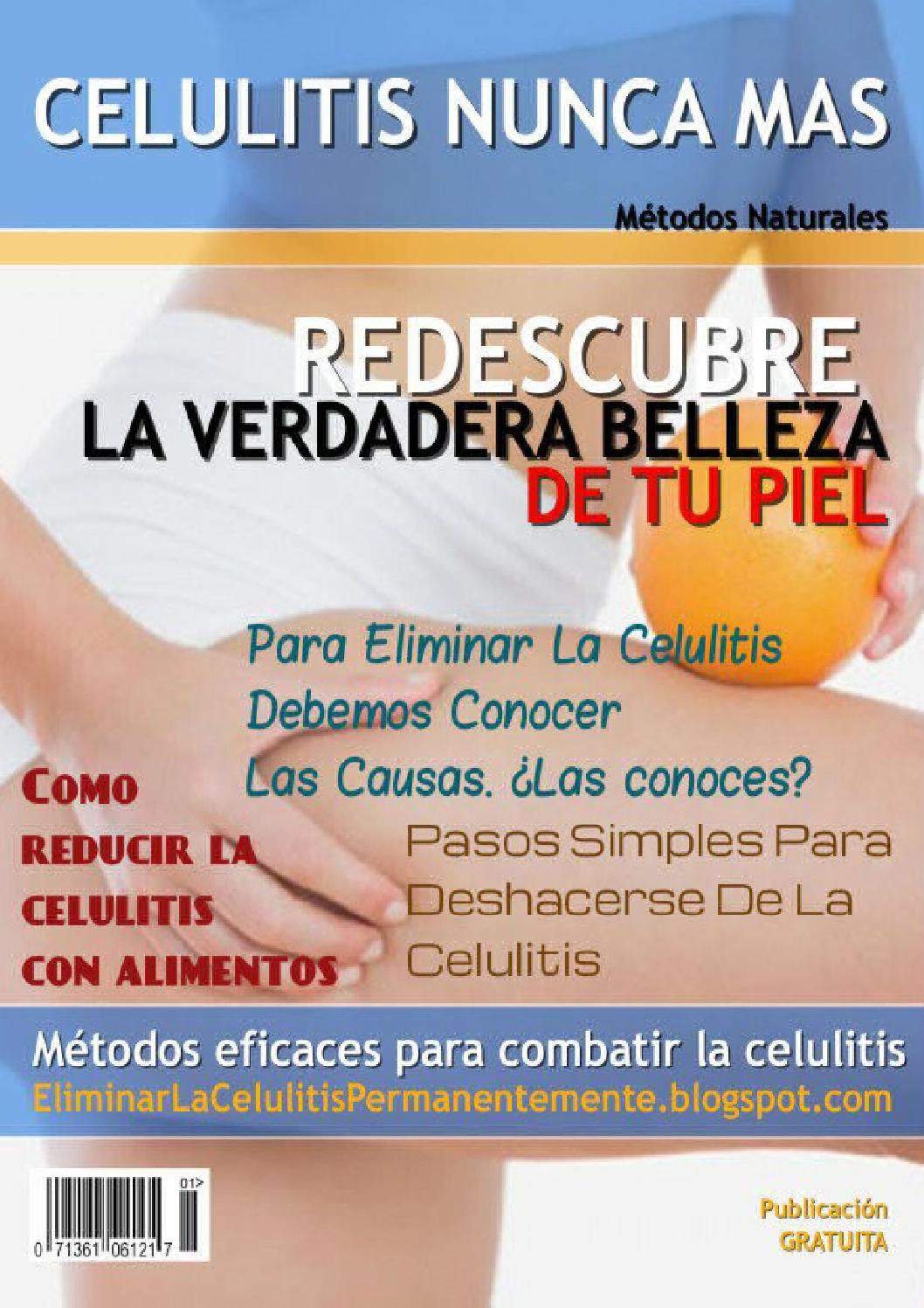 CNM Como Eliminar La Celulitis Para Siempre by Karolina Martinez Mendoza Issuu CNM Como Eliminar La Celulitis Para Siempre by Karolina Martinez Mendoza Issuu