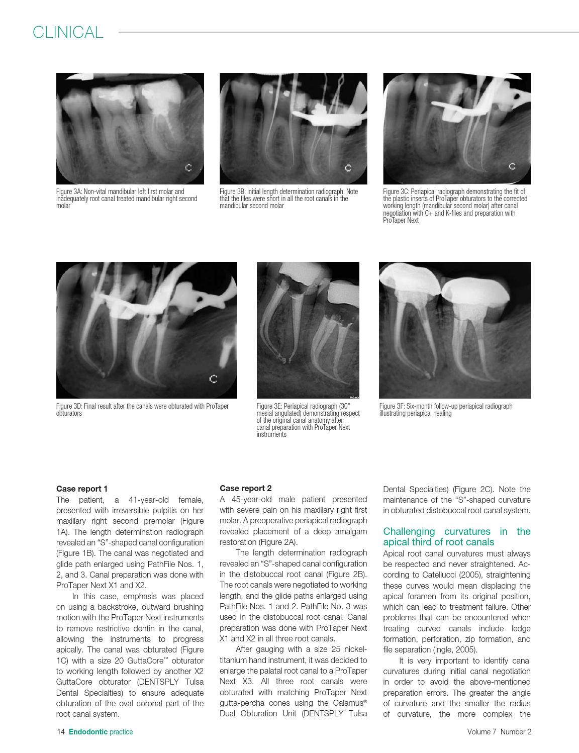 Endodontic Practice US March/April 2014 Vol7.2 AAE Show Issue by