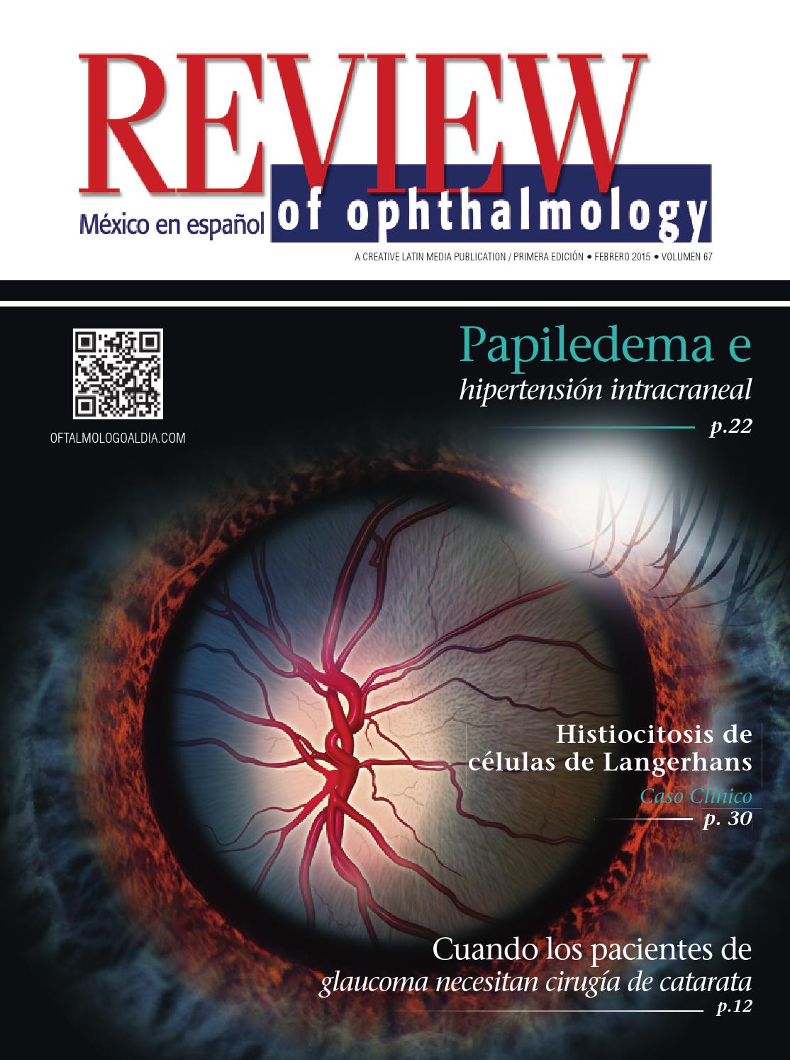 diabetes insípida estrechamiento arteriolar