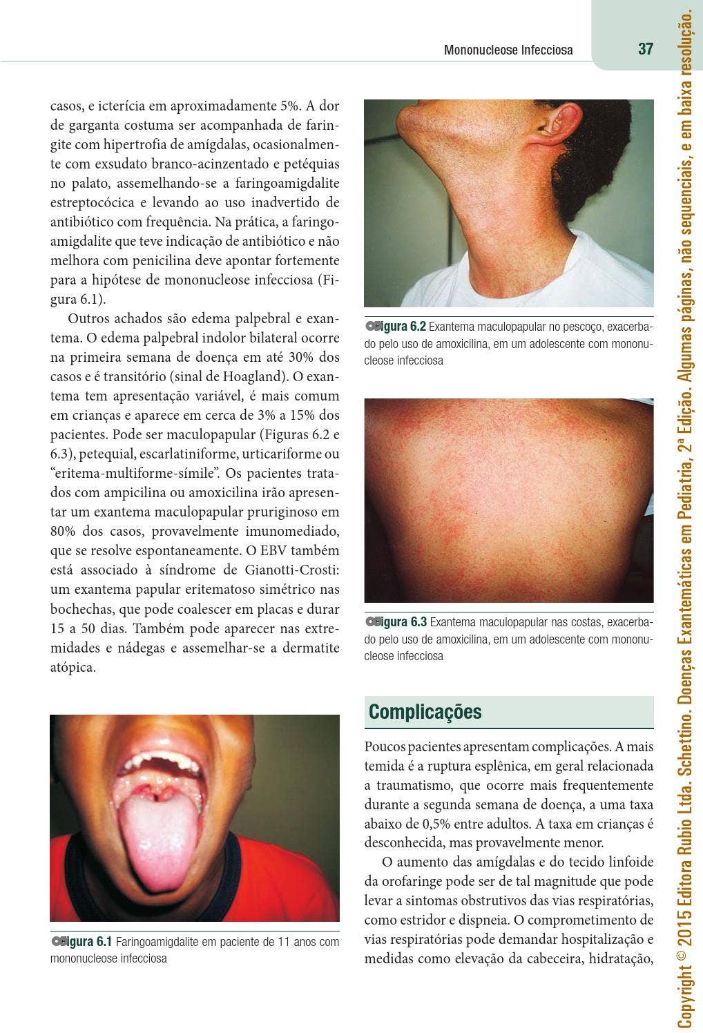 Doenças Exantemáticas em Pediatria | Carlos Eduardo Schettino by Editora  Rubio - Issuu, image size:1018x1496