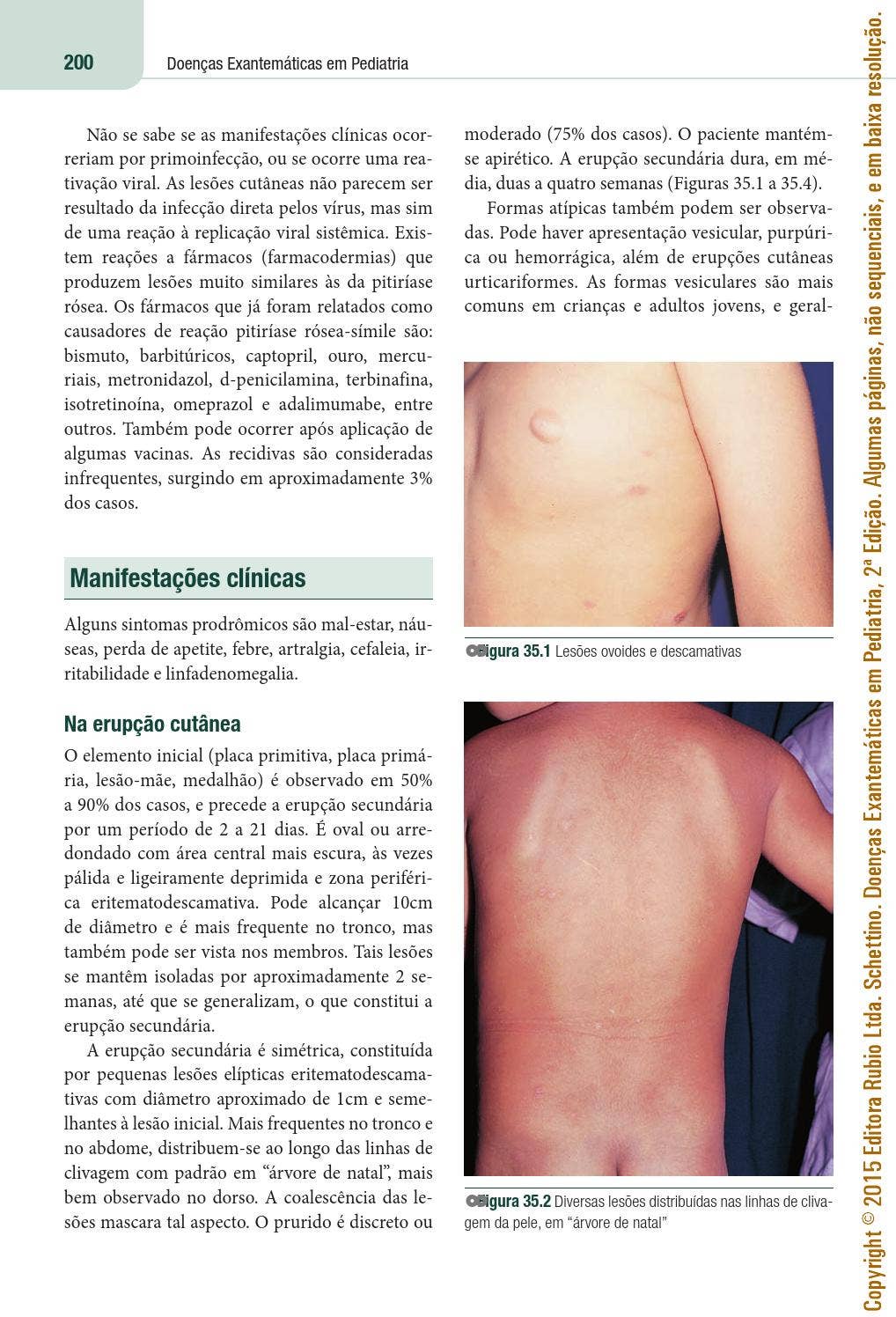 Doenças Exantemáticas em Pediatria | Carlos Eduardo Schettino by Editora  Rubio - Issuu, image size:1018x1496
