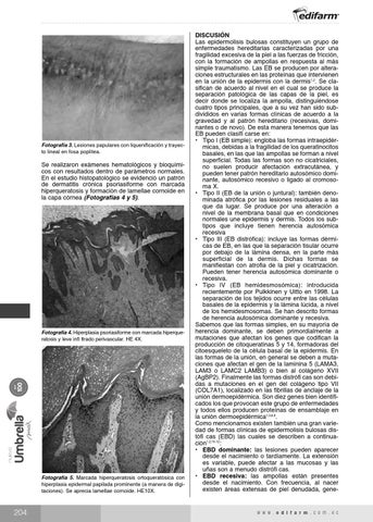 Page 222