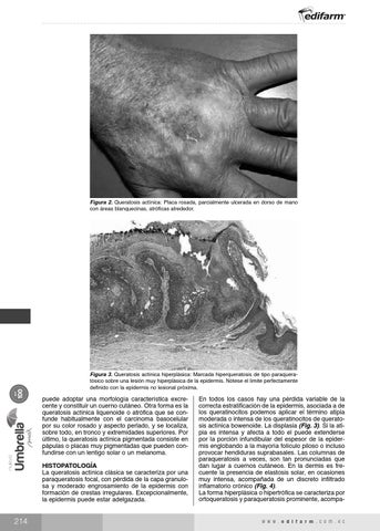 Page 232