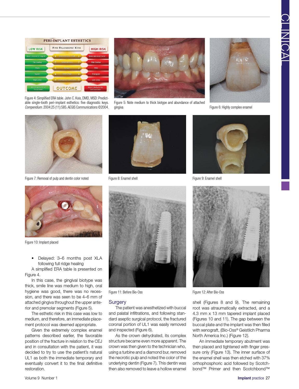 Implant Practice US February-March 2016 Vol 9 No 1 Issue by MedMark ...