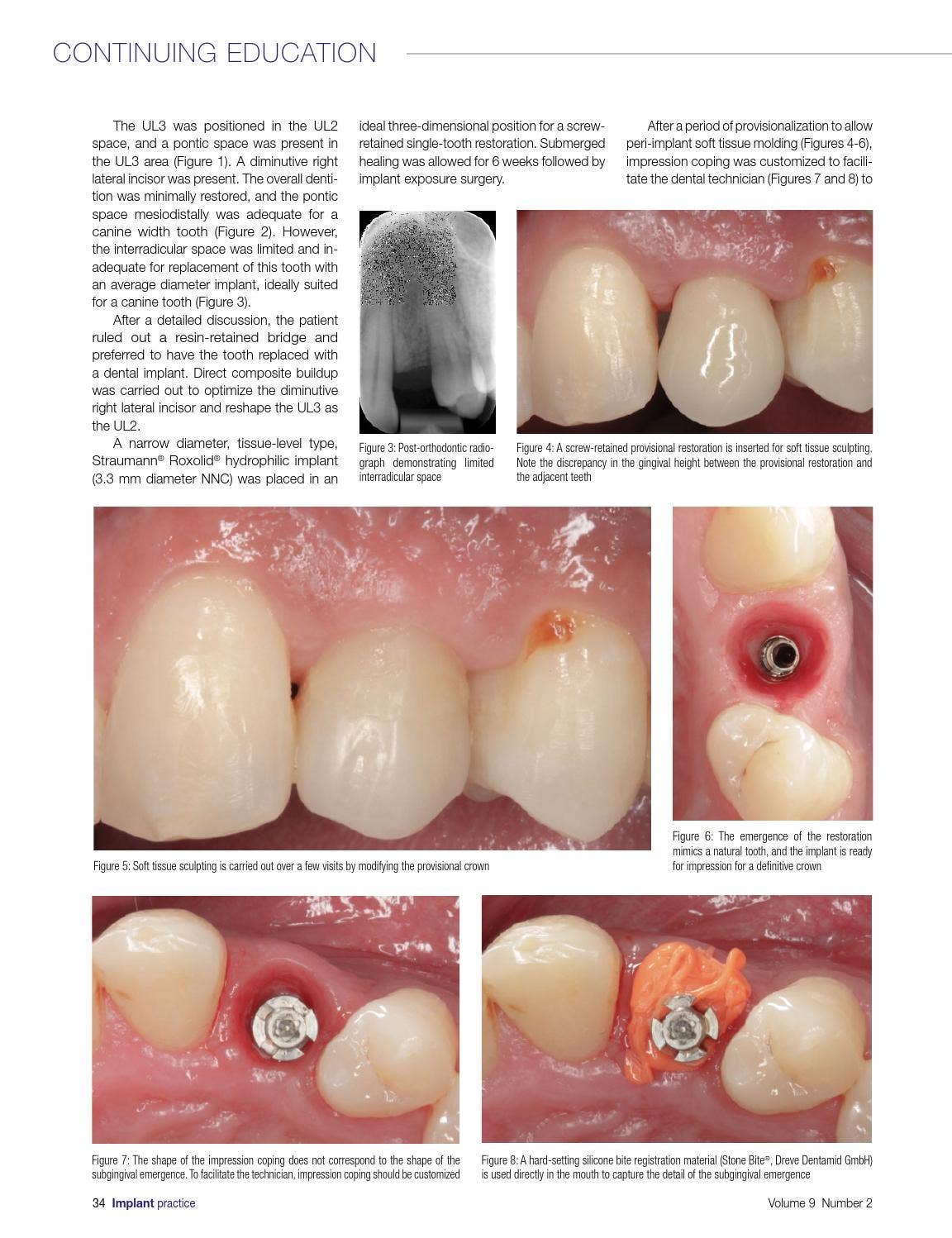 Implant Practice US April/May 2016 Vol 9, No 2 by MedMark, LLC - Issuu