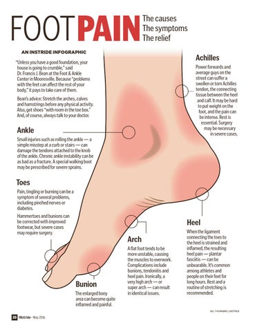 Swollen arch of foot hotsell