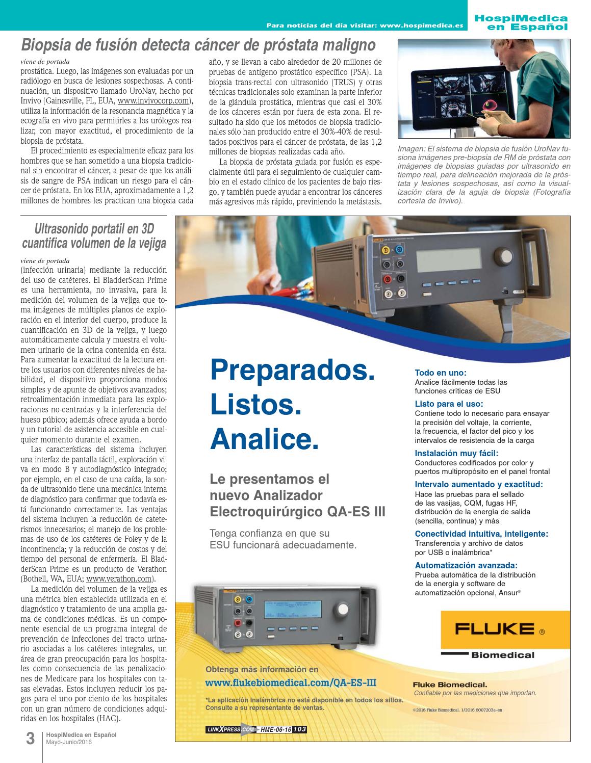 procedimiento de biopsia del trus prostático
