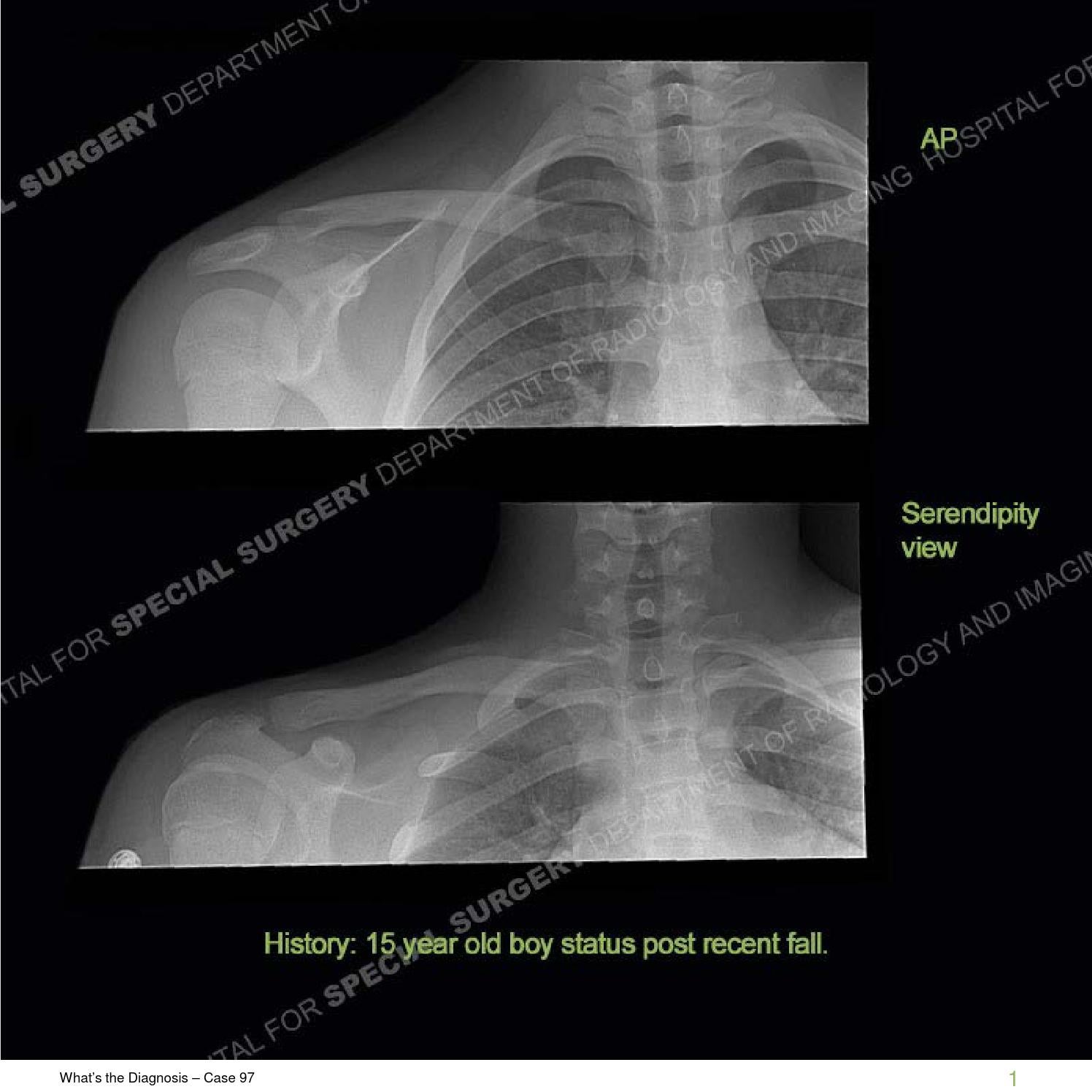 HSS What's the Diagnosis Case 97 by Hospital for Special Surgery Issuu