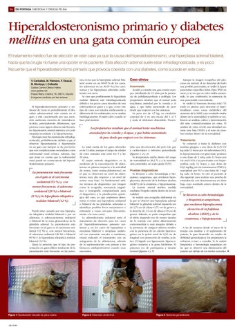 hiperaldosteronismo sintomas de diabetes