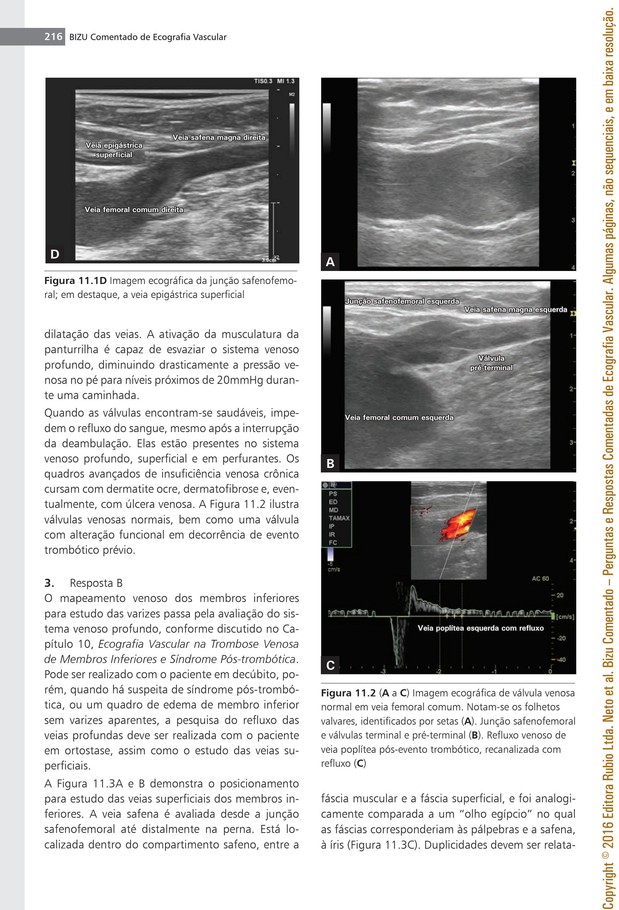 Dorso do pé após cirurgia no tornozelo