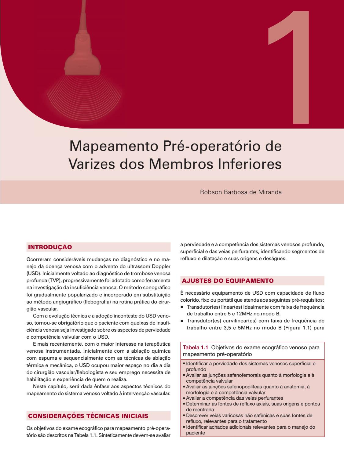 Das veias superficial ablação