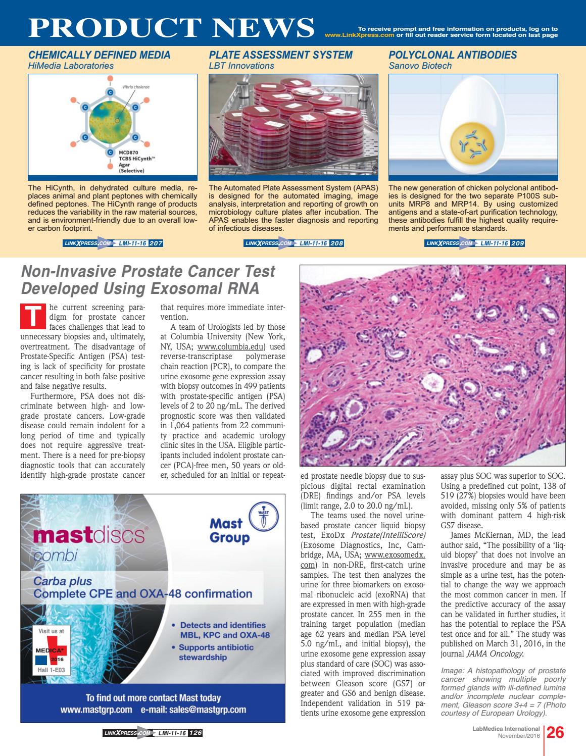 exodx prostate intelliscore exodx prostate intelliscore