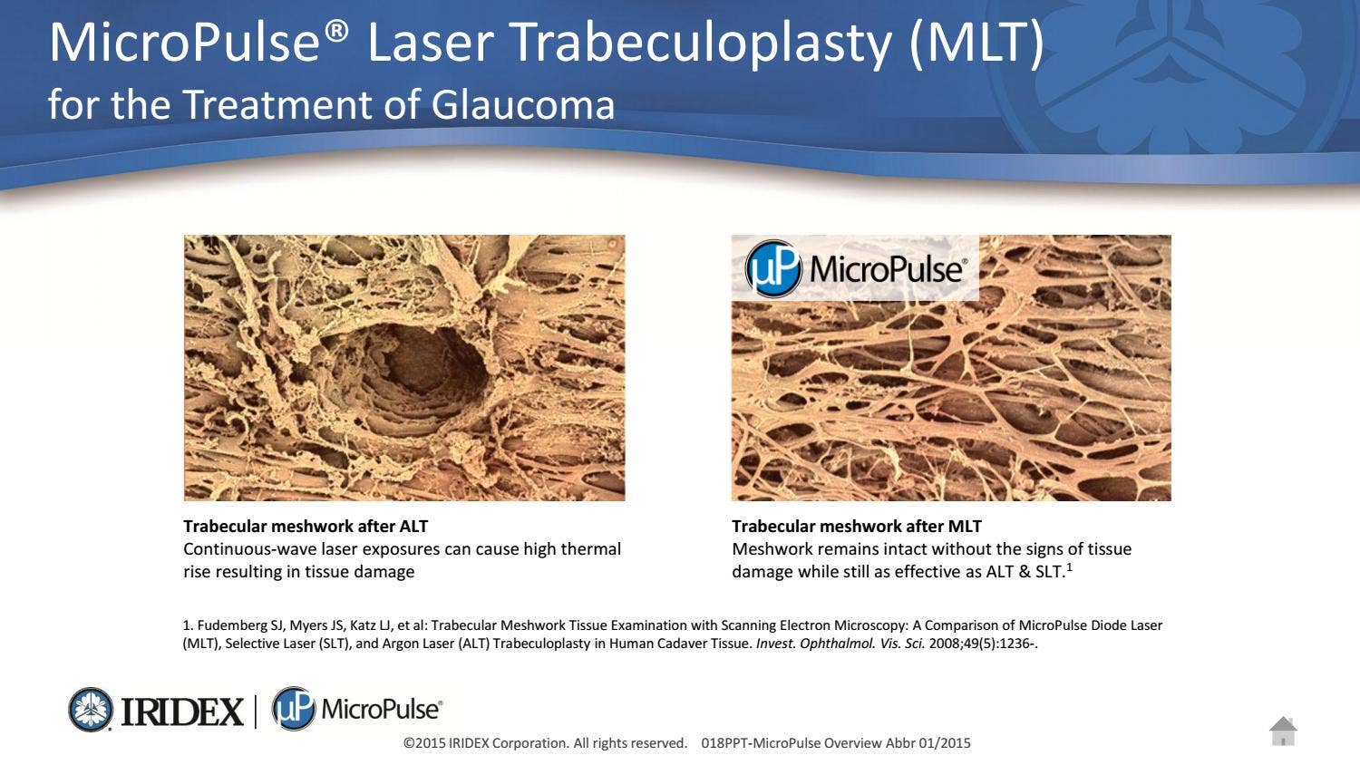 Micropulse en Trabeculoplastia by OftalTech Solutions - Issuu