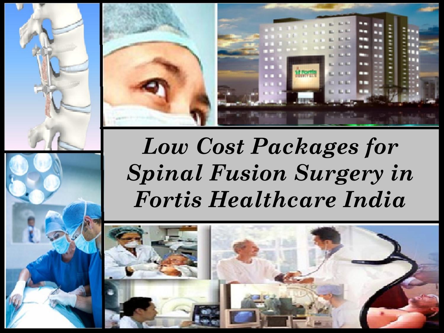 Low Cost Packages for Spinal Fusion Surgery in Fortis Healthcare India