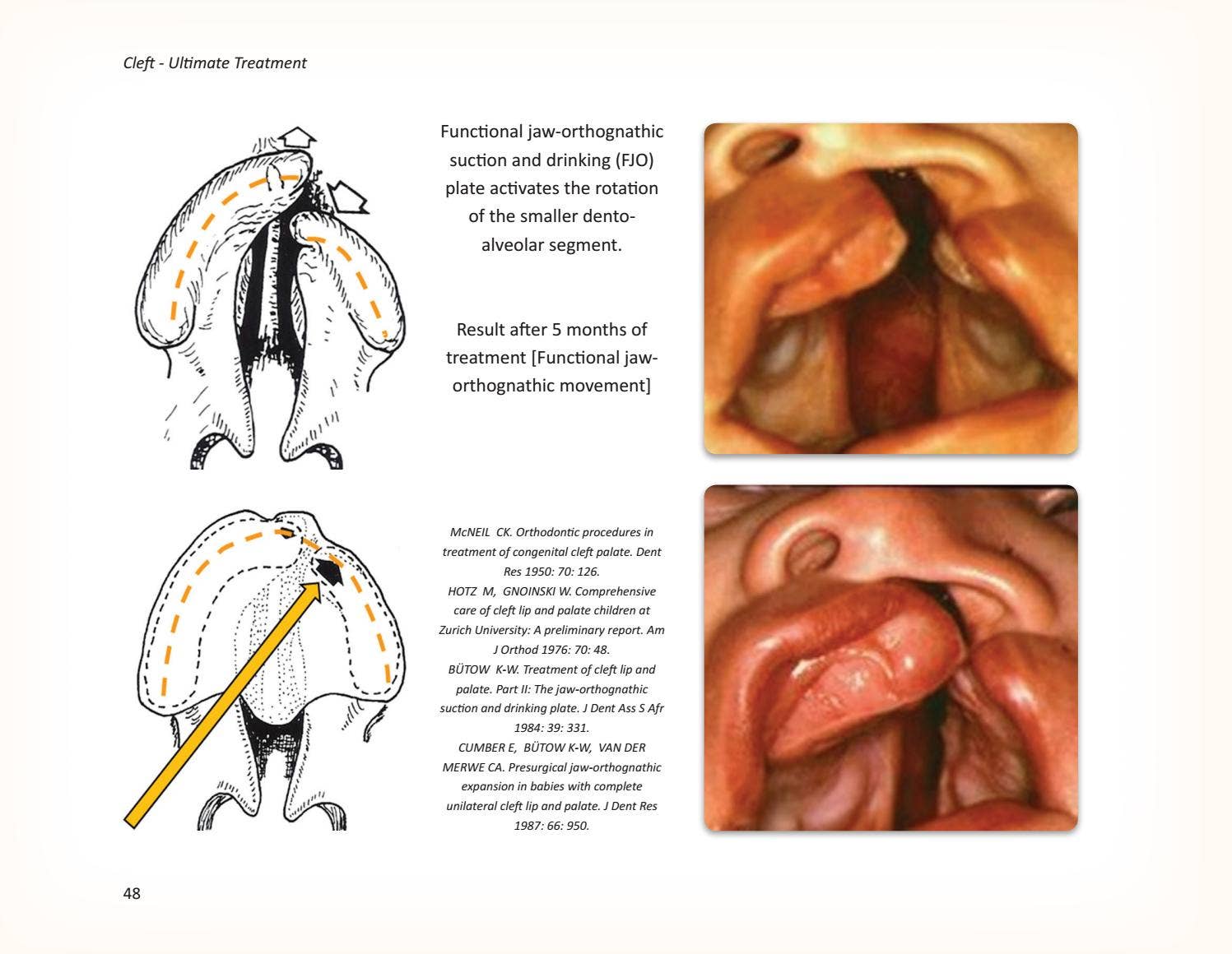 Cleft Ultimate Treatment by IAOMS - Issuu