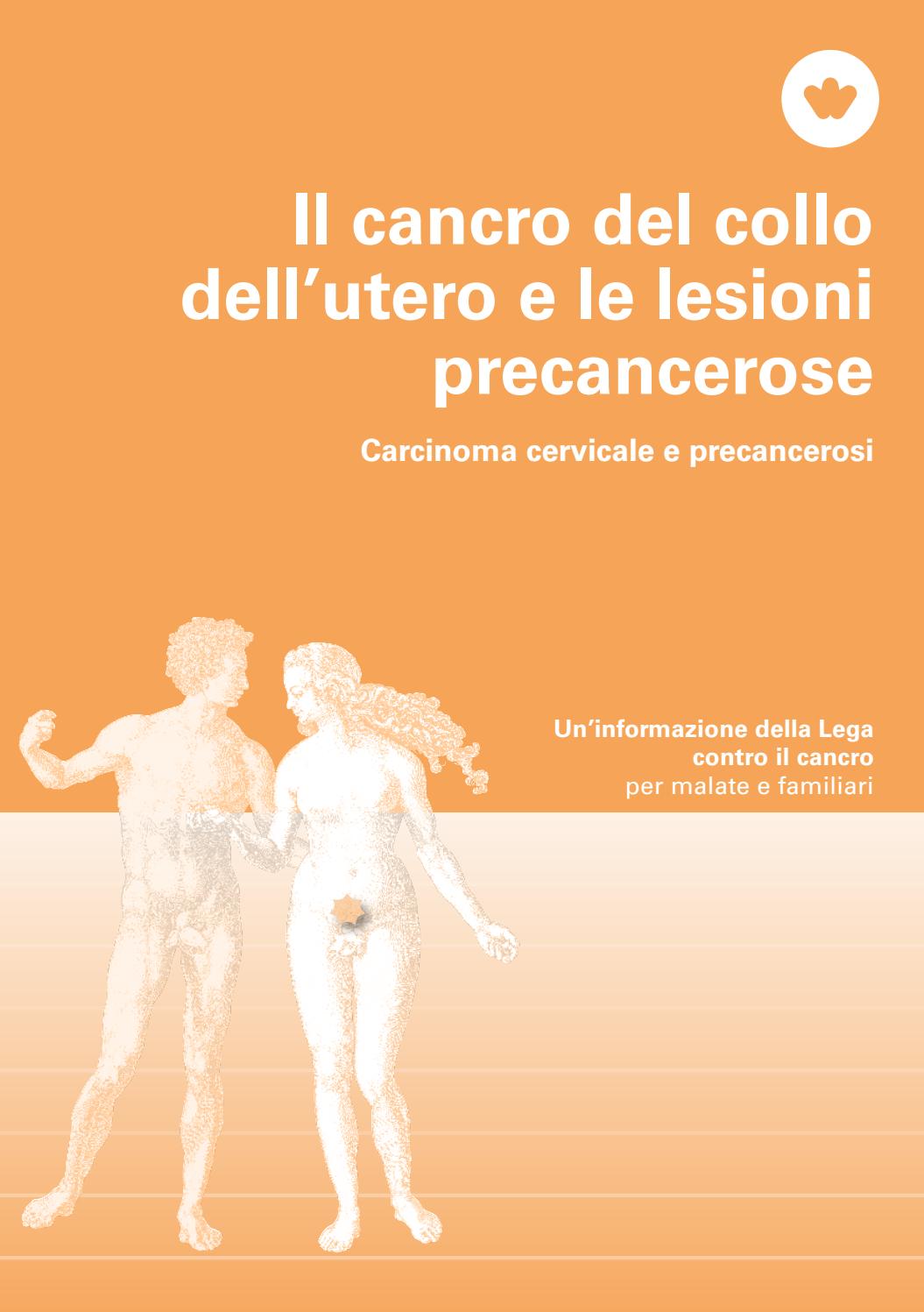 i sintomi della perdita di peso hanno avanzato il tumore ginecologico i sintomi della perdita di peso hanno avanzato il tumore ginecologico