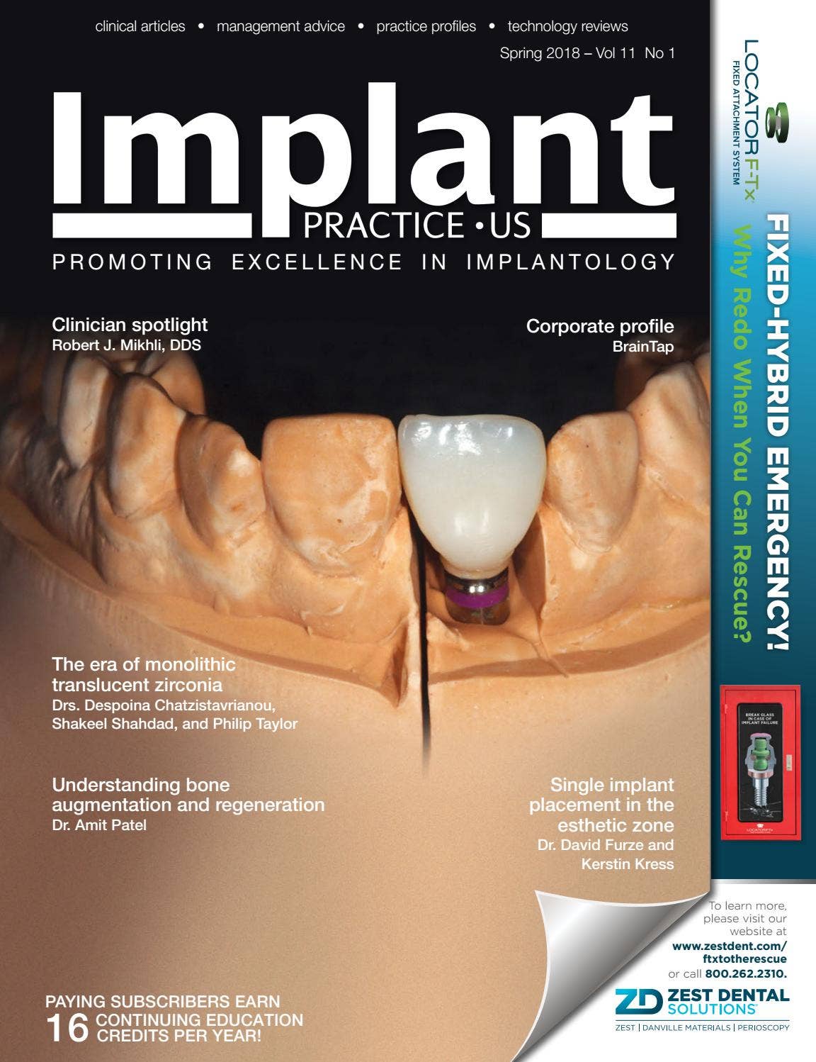 Implant Practice US Spring 2018 Vol 11 No 1 by MedMark, LLC - Issuu