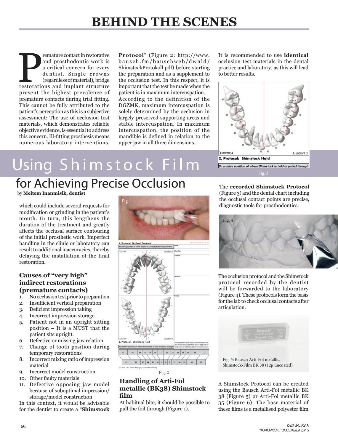 Using Shimstock Film for achieving precise occlusion by Pablo Zulaica