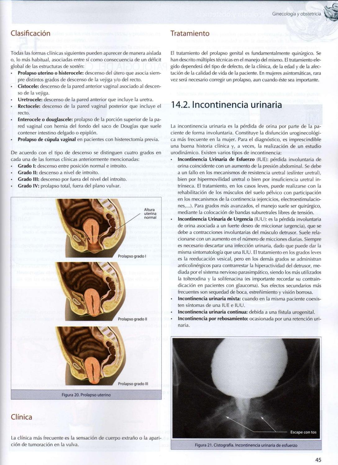 Grados del prolapso genital