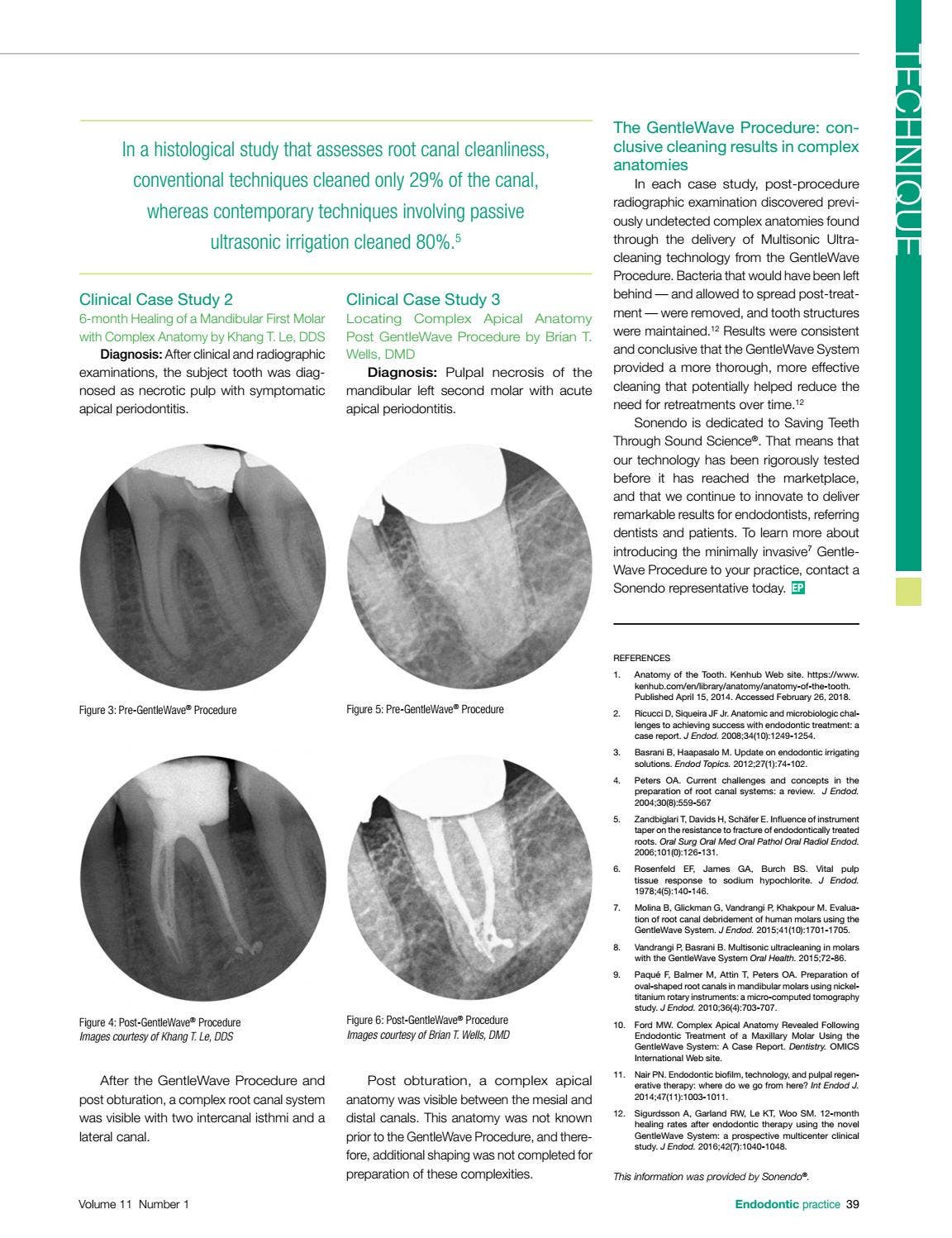 Endodontic Practice US Spring 2018 Vol 11 No 1 by MedMark, LLC - Issuu