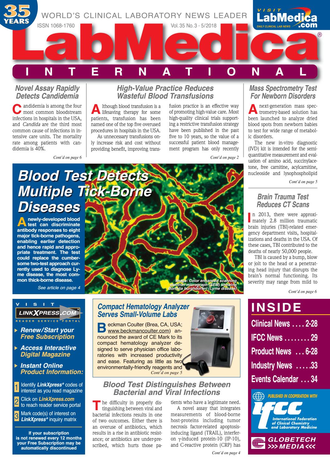 diagnóstico de bilharziasis de diabetes