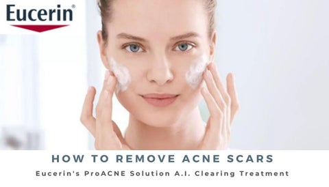 eucerin for acne scars