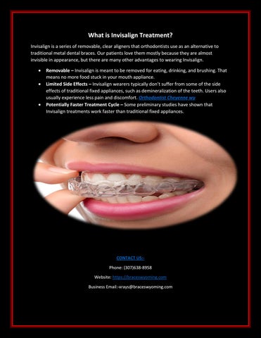 How to get Invisalign Costs