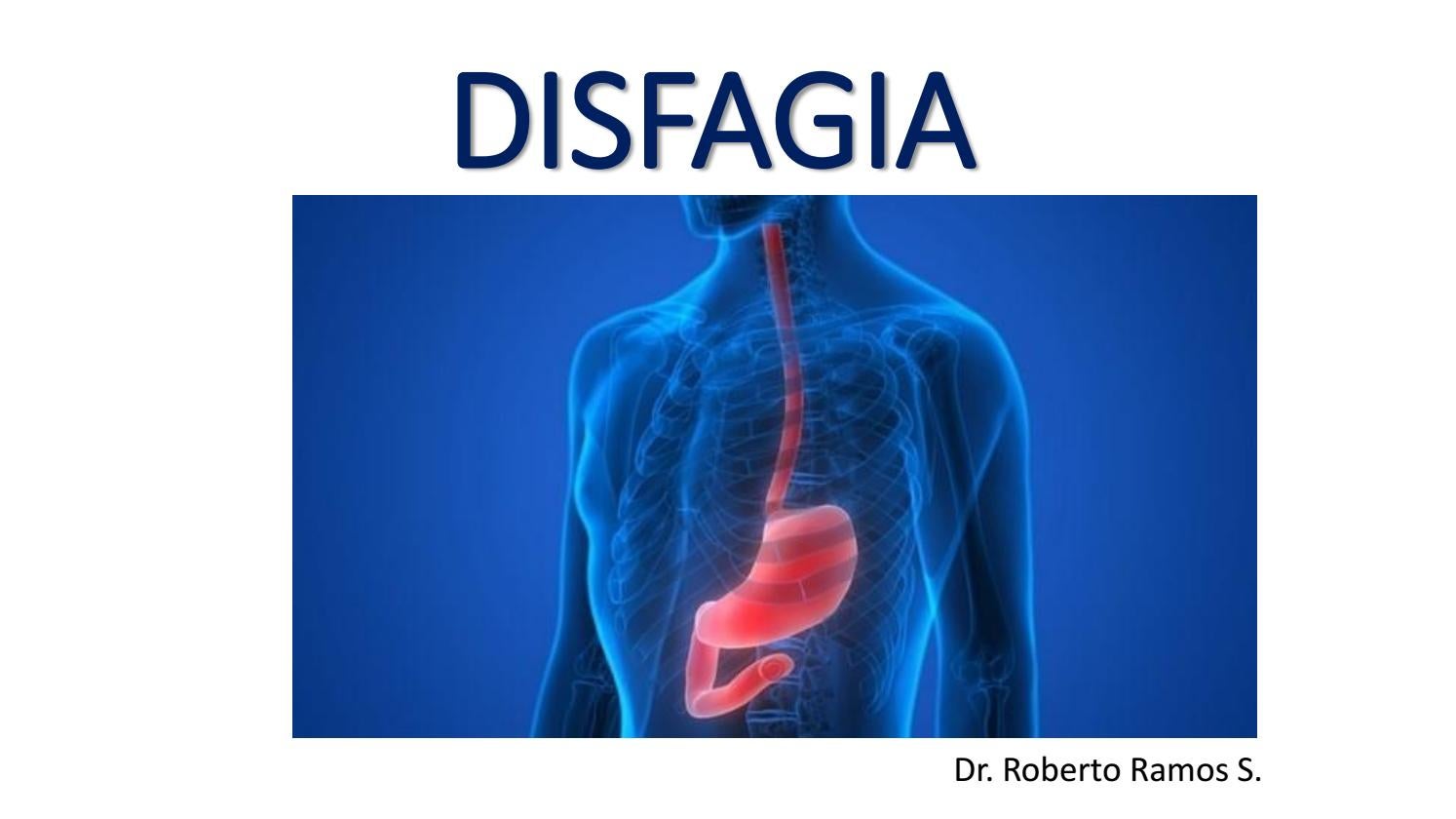 dieta para hernia de hiato y esofagitis