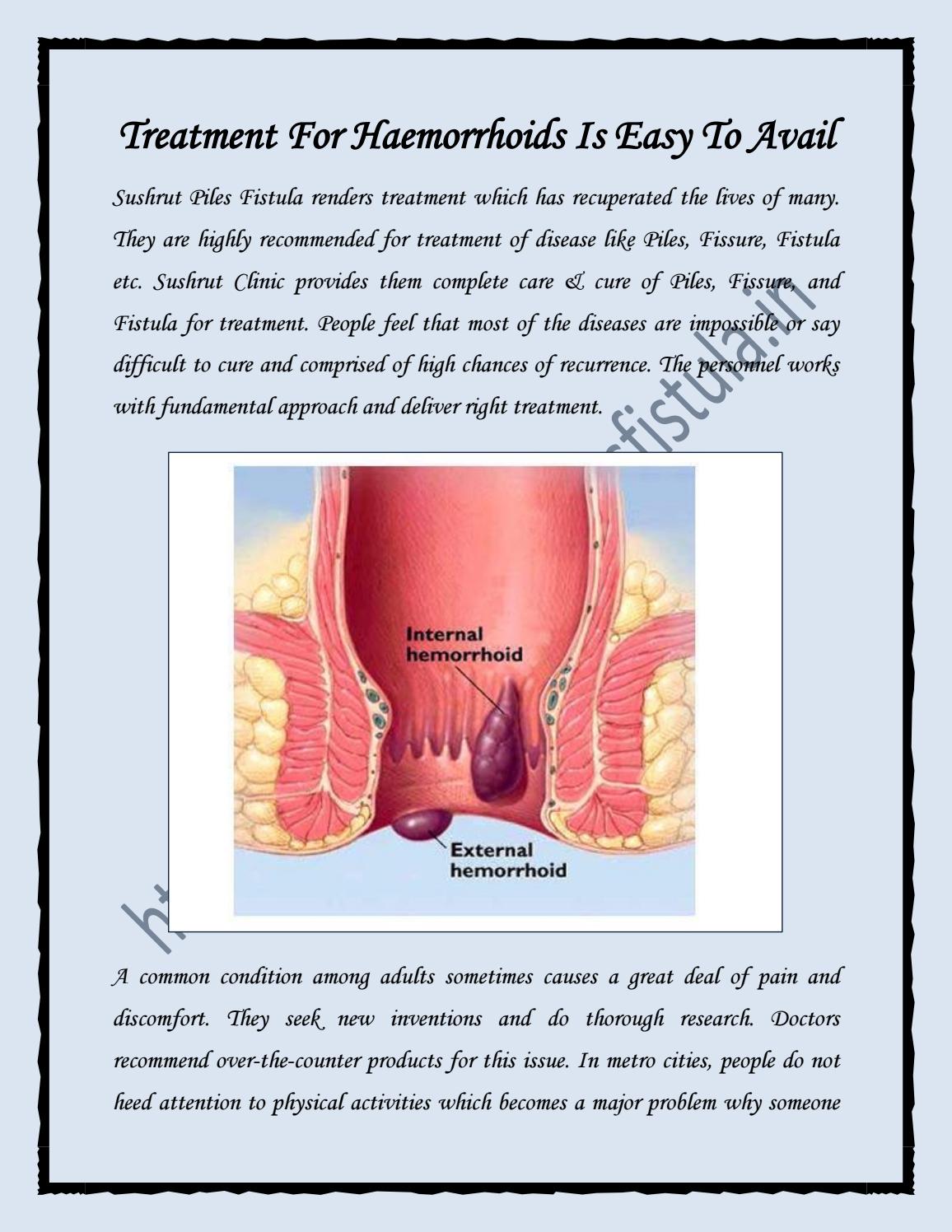 Treatment For Hemorrhoids in Mumbai Call Us 9870276150 by Dombivali