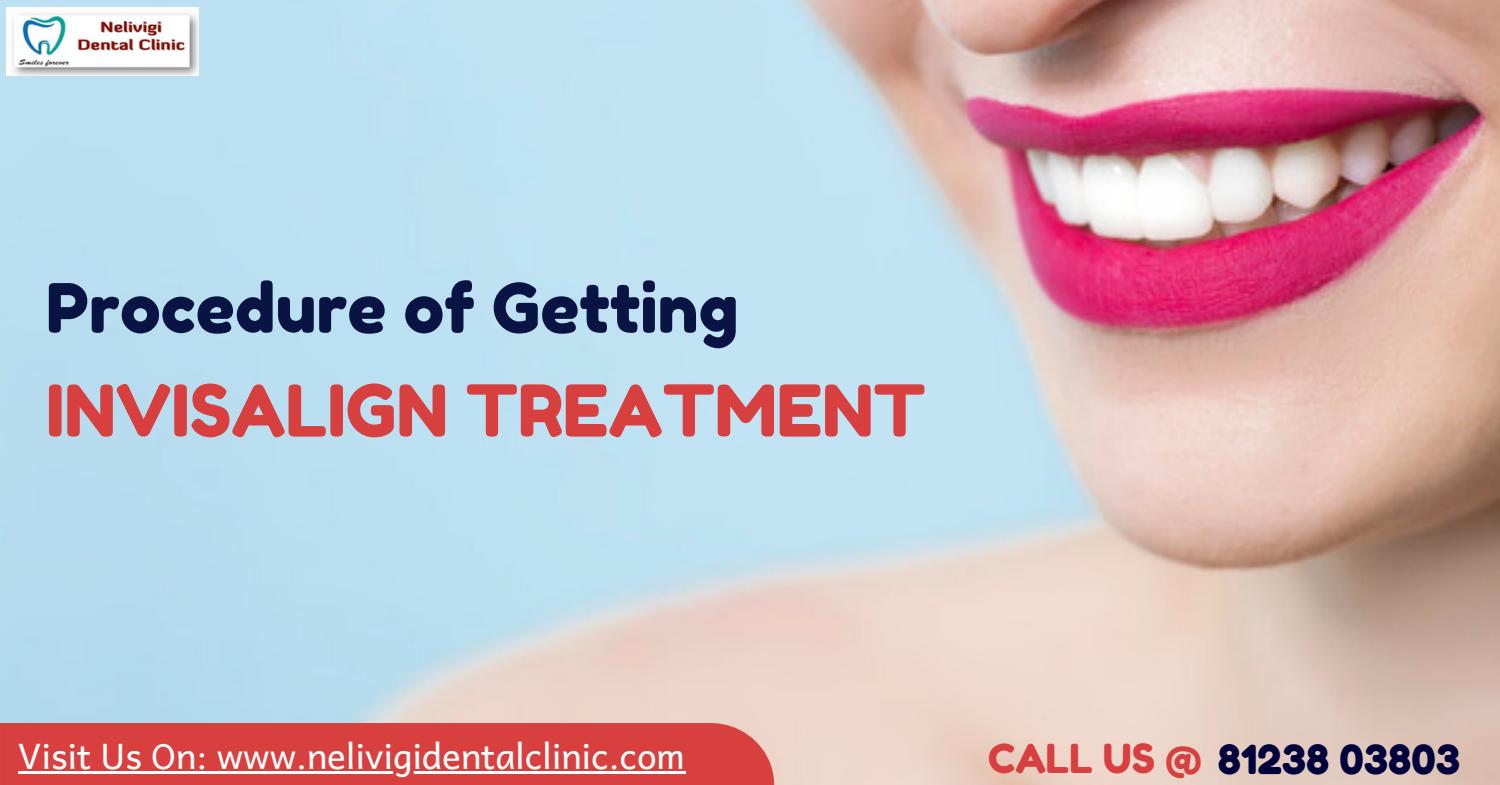 Procedure of Getting Best Invisalign Treatment Near me Bangalore by drnandininelivigi Issuu