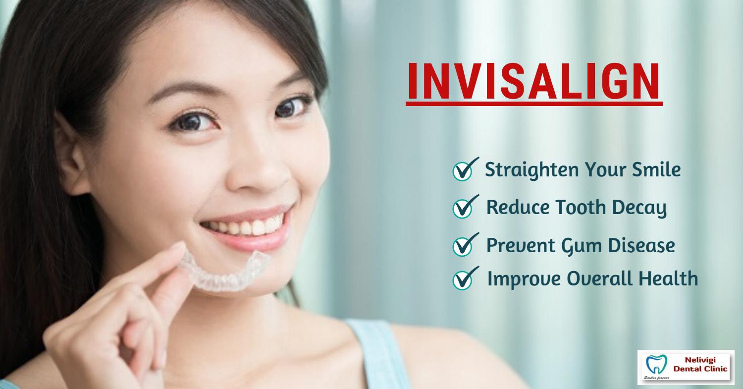 Benefits of INVISALIGN Best Invisalign Treatment Near me Bangalore by drnandininelivigi Issuu