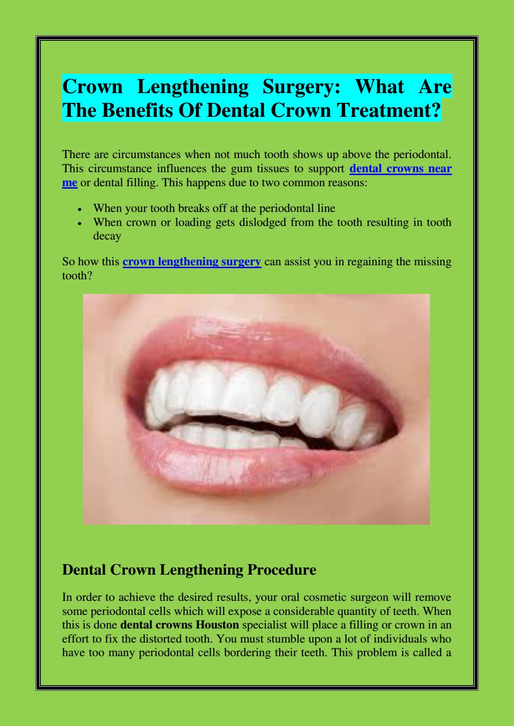 Crown Lengthening Surgery What Are The Benefits Of Dental Crown