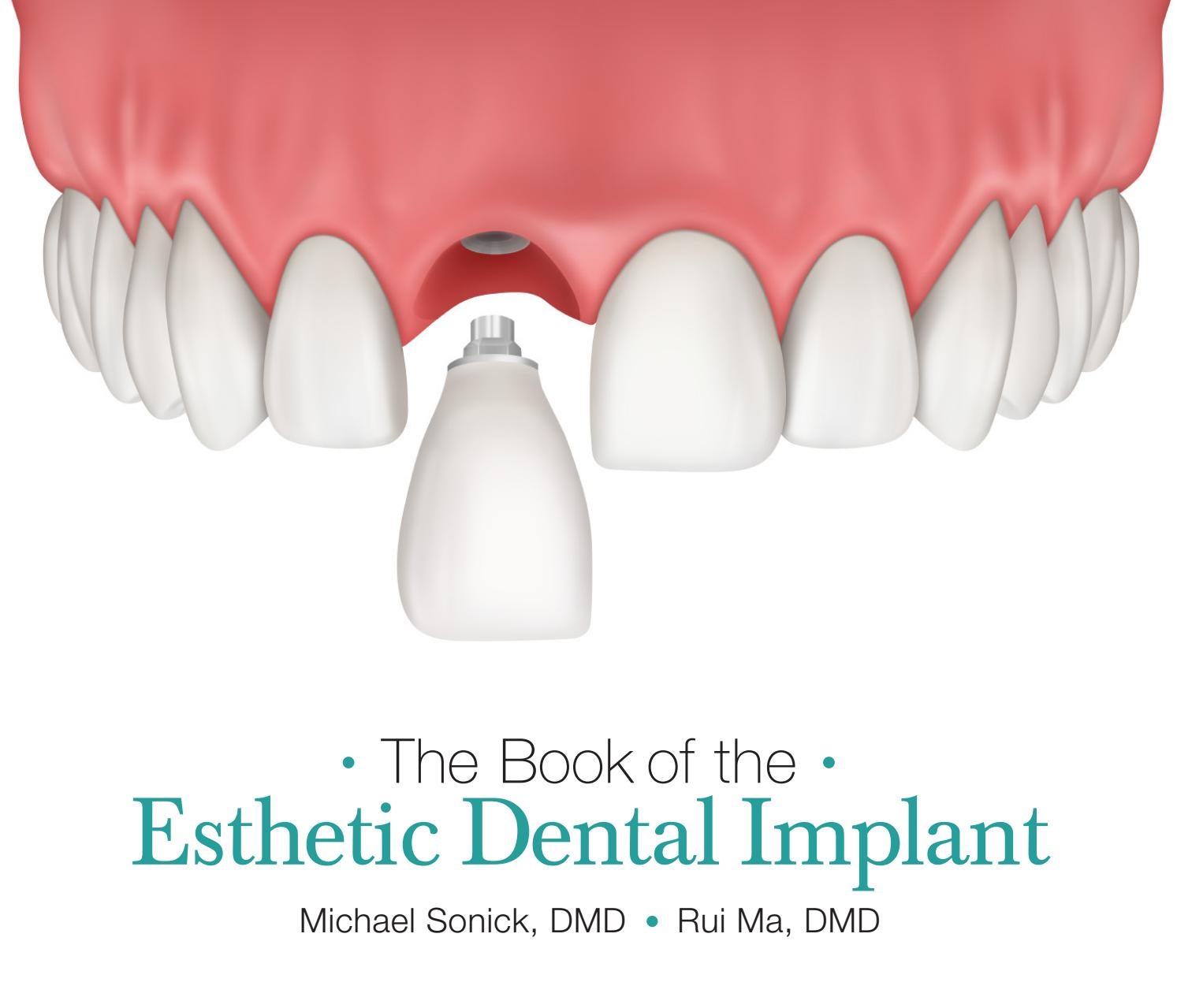 The Book of the Esthetic Dental Implant by sonickdmd2 Issuu