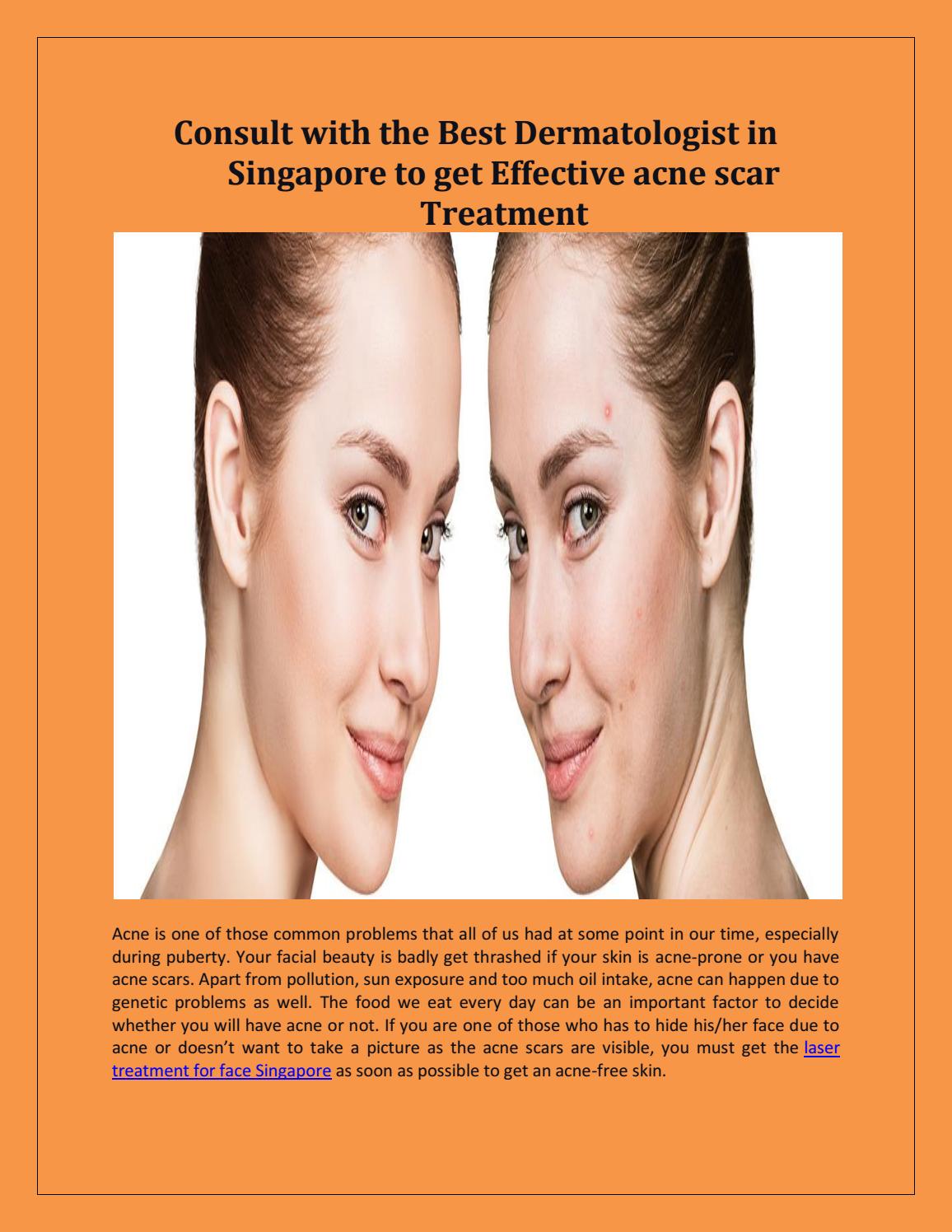 best dermatologist treatment for acne scars