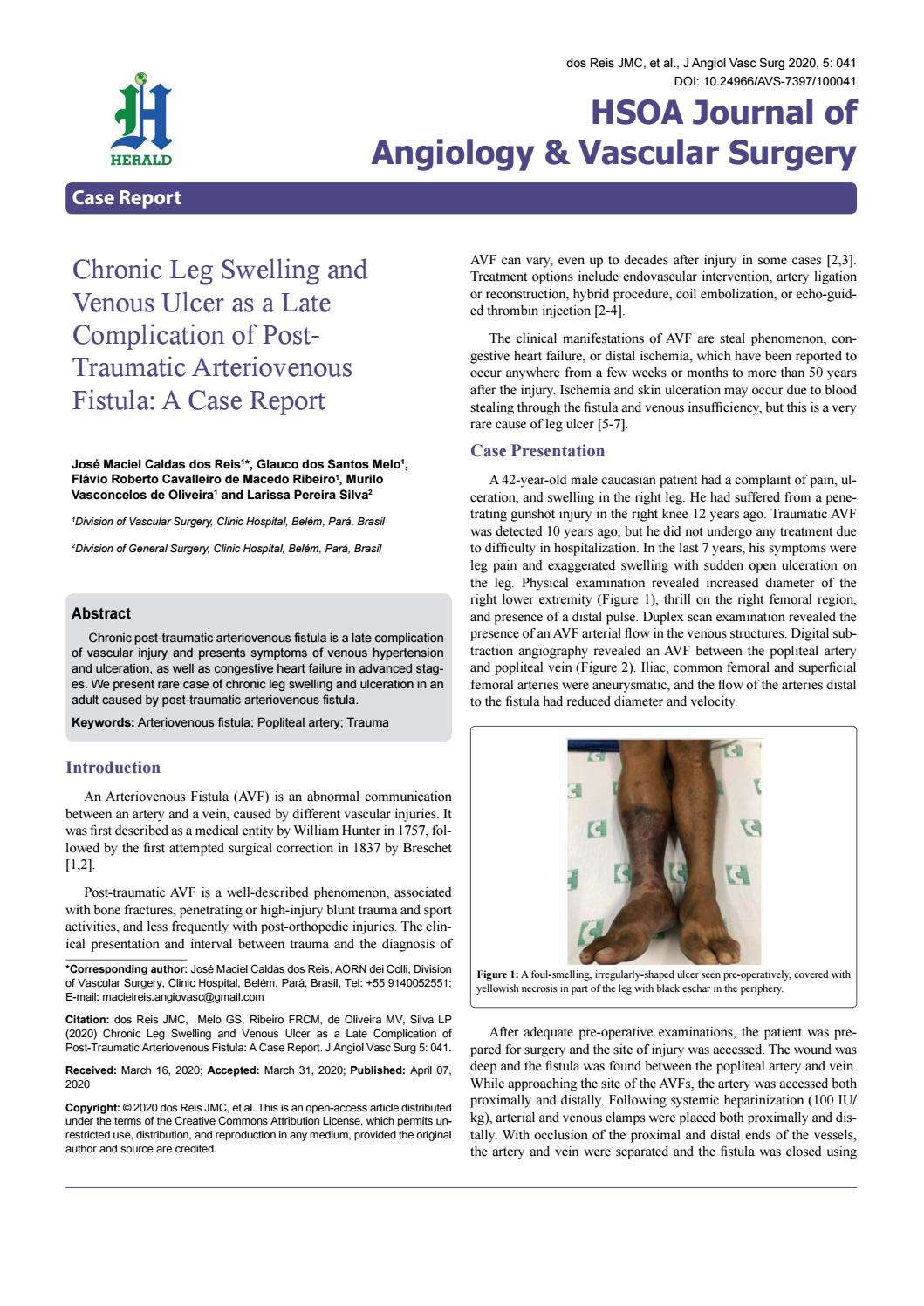 Chronic Leg Swelling And Venous Ulcer As A Late Complication Of Post