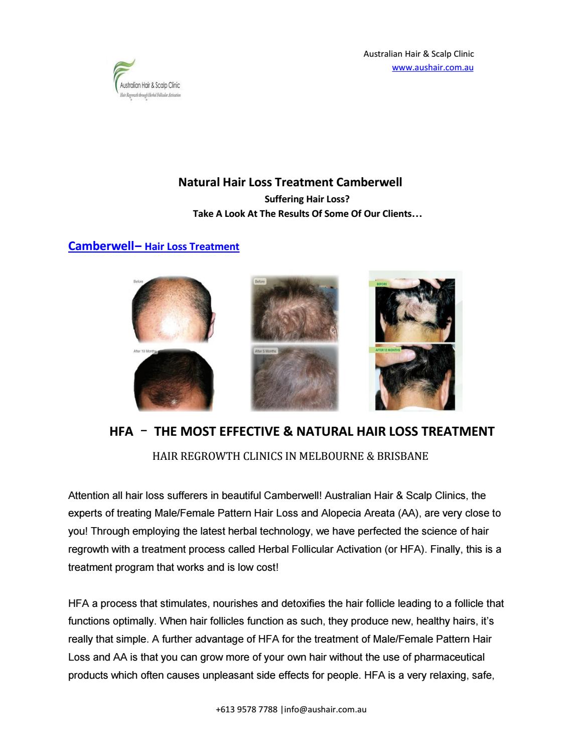Natural Hair Loss Treatment Camberwell by Australian Hair & Scalp
