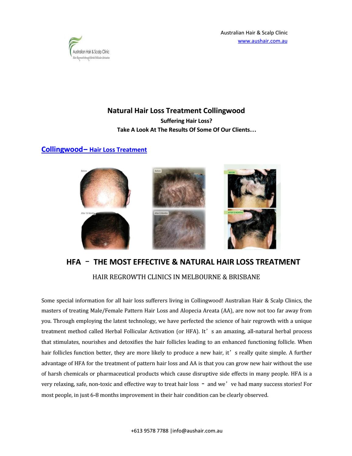 Natural Hair Loss Treatment Collingwood by Australian Hair & Scalp